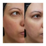 سرم ویتامین سی 23% کوزارکس COSRX ضد لک و روشن‌کننده 20میل اصل کره جنوبی - Image 3